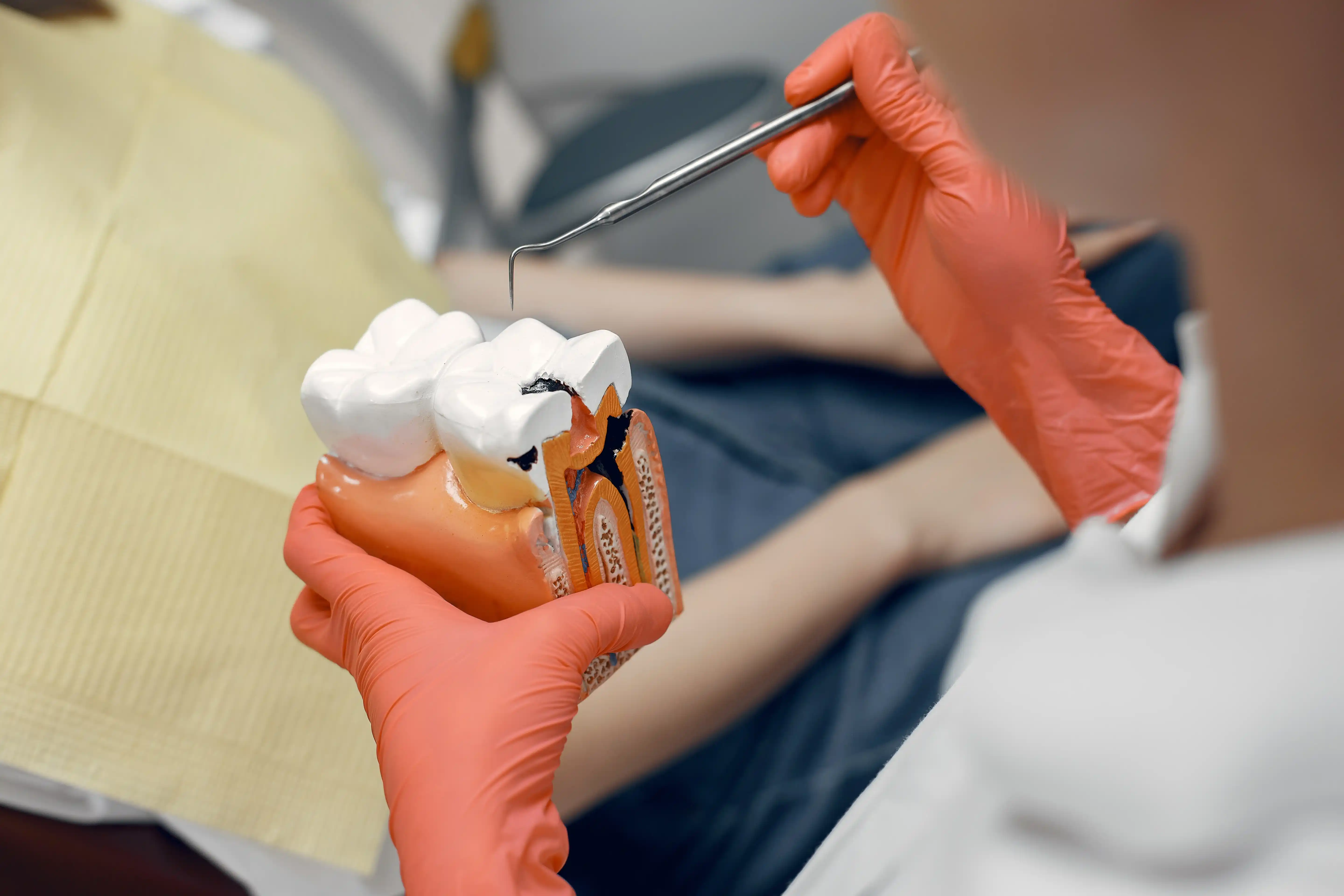 Imagen de endodoncia