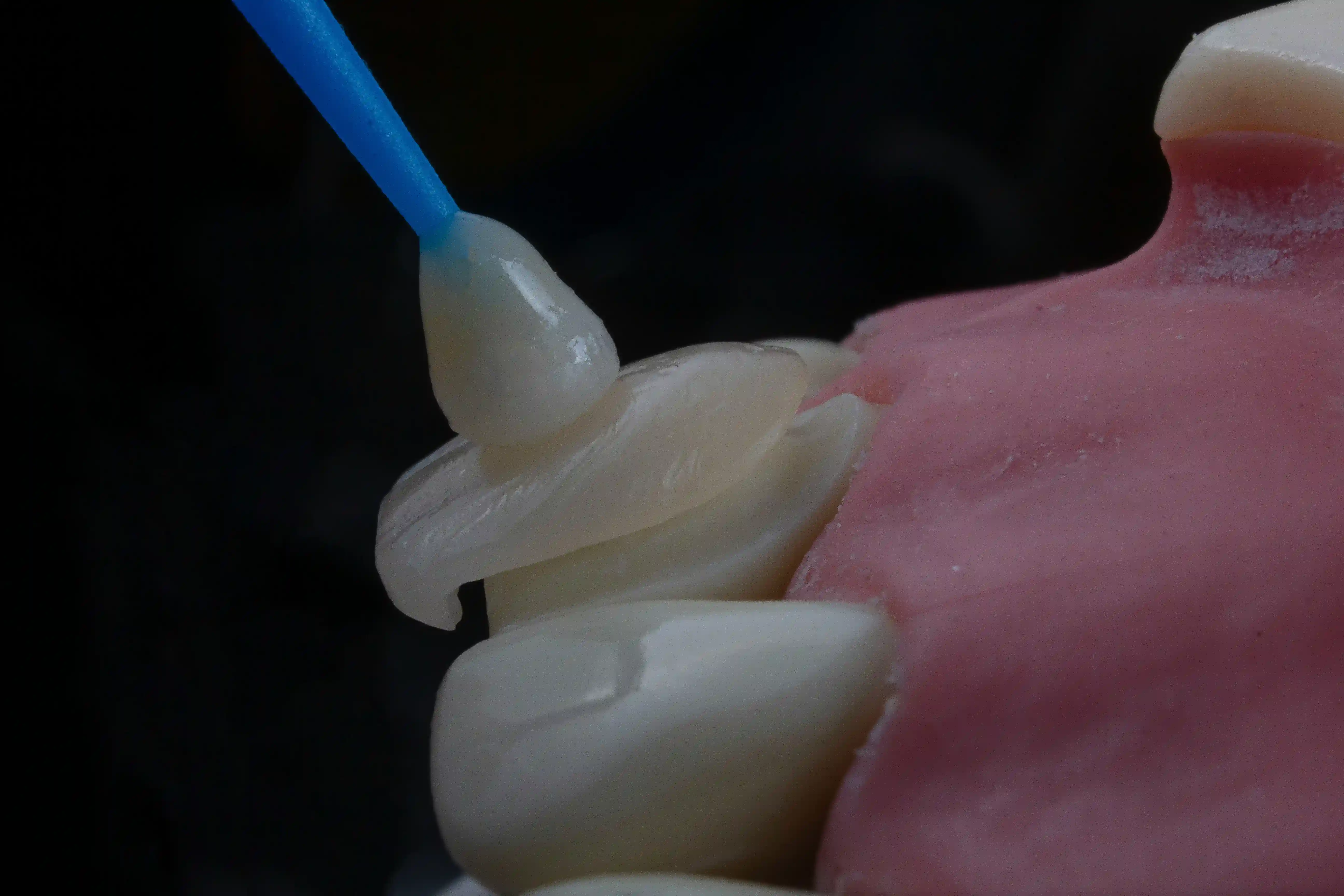Imagen de rehabilitación oral